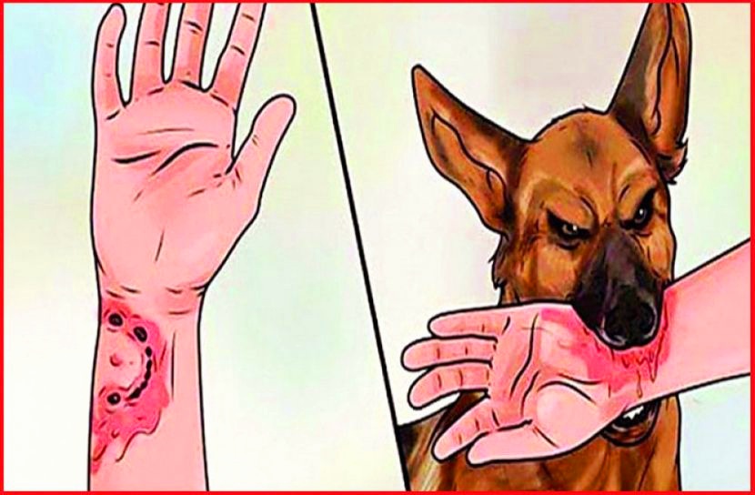 শিবচরে পাগলা কুকুরের কামড়ে ১২ জন আহত