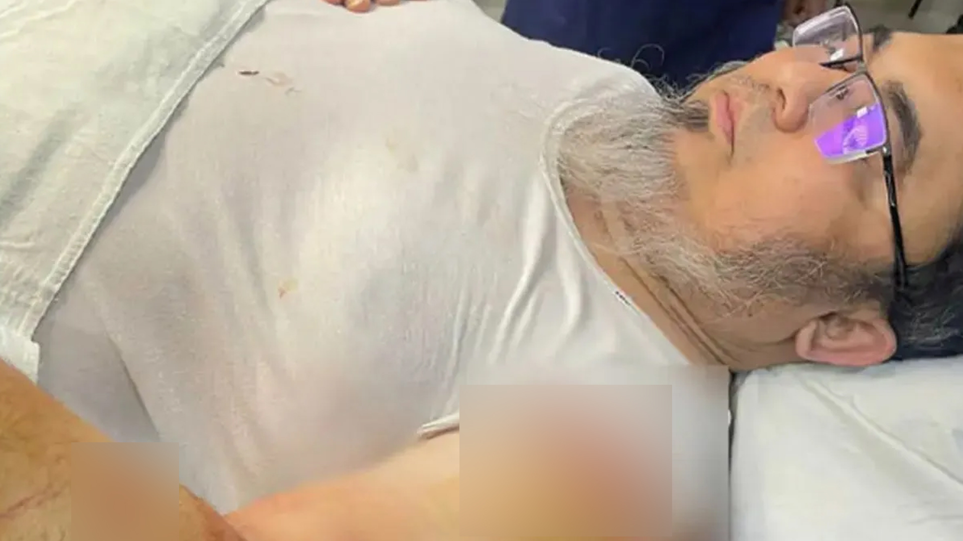 কুপিয়ে জখম 