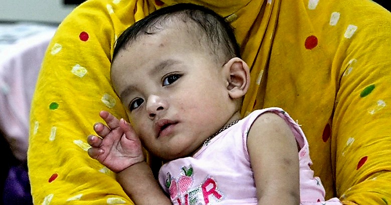 হামে আরও ৪ শিশুর মৃত্যু
